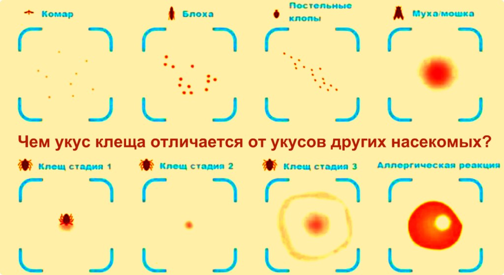 Как выглядят укусы клопов на лице Как выглядят укусы клопов на лице